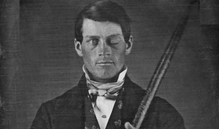 Was phineas gage lucky or unlucky